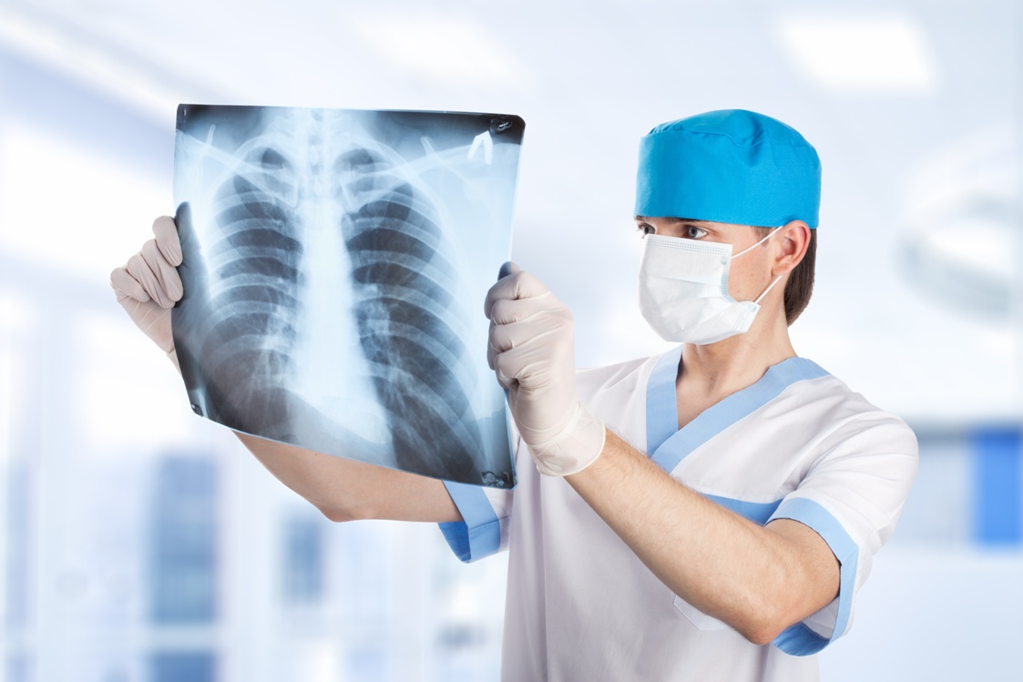 medical doctor looking at x-ray picture of lungs in hospital